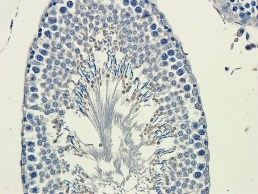 ATF6 antibody