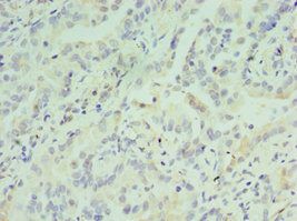 ATF7 Antibody