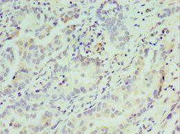 ATF7 Antibody