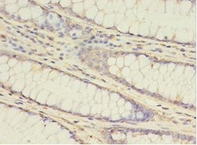 ATG16L1 Antibody