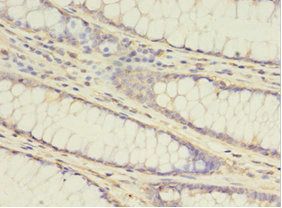 ATG16L1 antibody