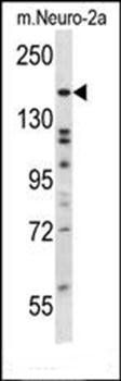 ATG2B antibody