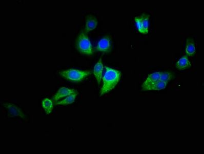 ATG2B Antibody