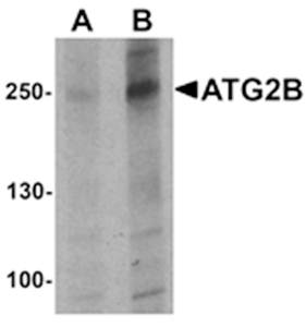 ATG2B Rabbit Polyclonal Antibody