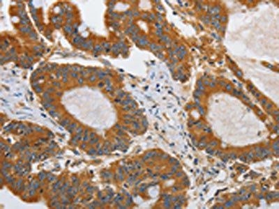 ATG4A Antibody