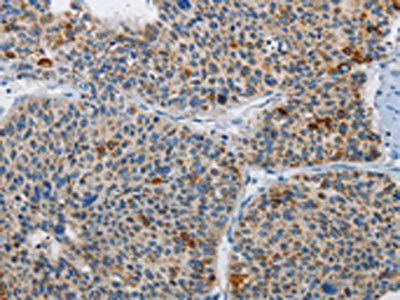 ATG4A Antibody