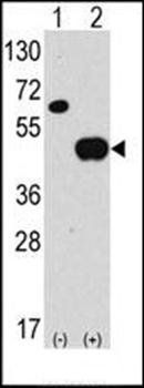 ATG4B antibody