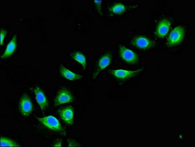 ATG4B Antibody