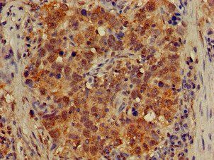 ATG4B Antibody