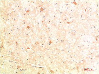 ATG4B Antibody