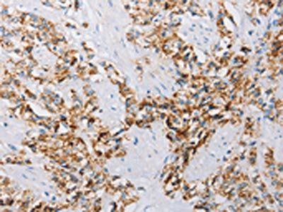 ATG4C Antibody