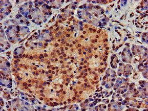 ATG4D Antibody