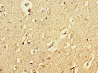 ATG5 Antibody