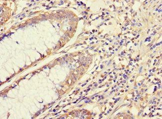 ATG5 Antibody