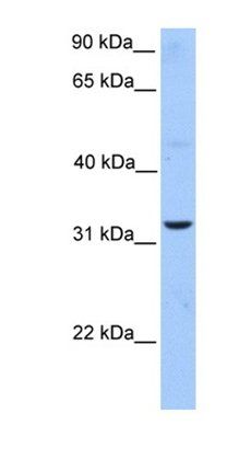 ATG5 antibody