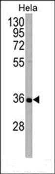 ATG5 antibody