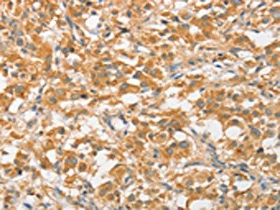 ATG5 Antibody