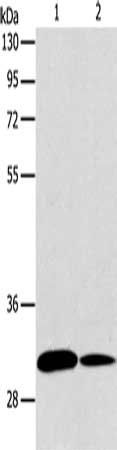 ATG5 antibody