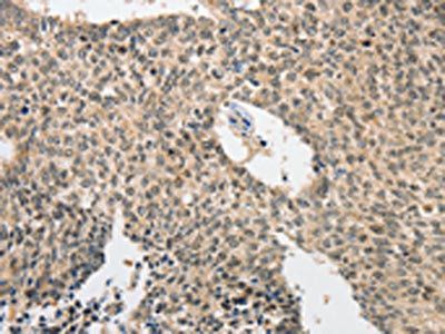 ATG5 Antibody