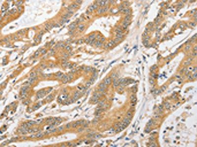 ATG5 Antibody