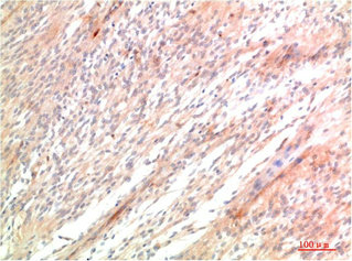 ATG5 Antibody