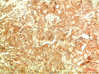 ATG5 Monoclonal Antibody