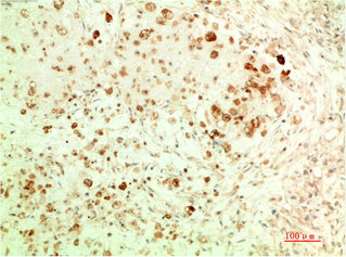 ATG5 antibody