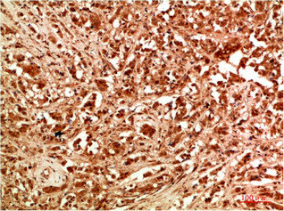 ATG7 Antibody