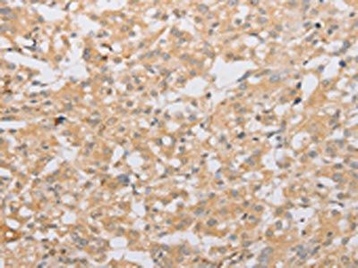 ATG9A Antibody