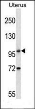 ATG9B antibody