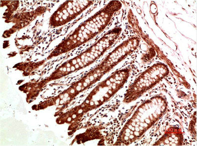 ATM antibody