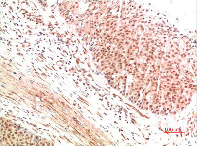 ATM Antibody