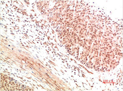 ATM antibody