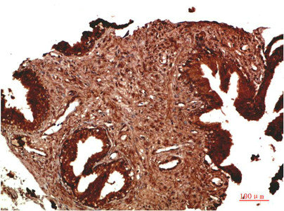 ATM antibody