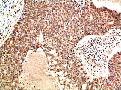 ATM Antibody