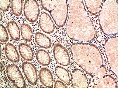ATM Antibody