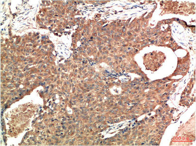 ATM Antibody