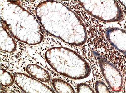 ATM Antibody