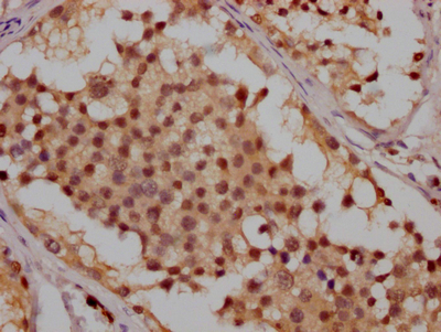 ATM Recombinant Monoclonal Antibody