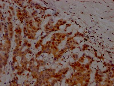 ATM Recombinant Monoclonal Antibody