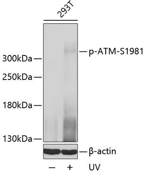 ATM (Phospho-S1981) antibody