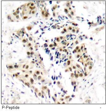 ATM (Phospho-Ser1981) Antibody