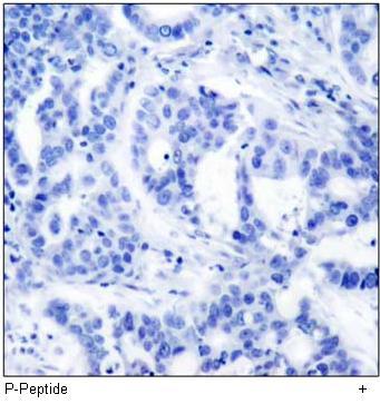 ATM (Phospho-Ser1981) Antibody