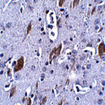 ATOH8 Antibody