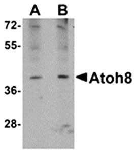 ATOH8 Antibody