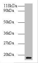 clpS Antibody