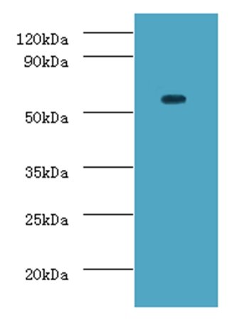 DDX19A Antibody (Biotin)