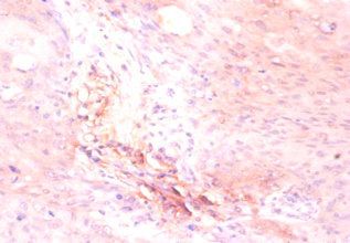ATP5F1D Antibody