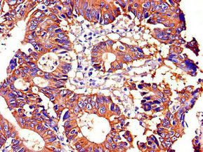 ATP1A1 Antibody