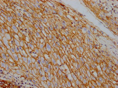 ATP1A1 Recombinant Monoclonal Antibody